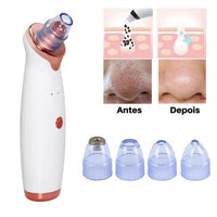 Removedor de cravos por dermo sucção, cravos, espinhas, mulher, beleza feminina, mulher, saúde e beleza, frete grátis, parcelamento em até 12x, estética, atitude feminina, attitude feminina.