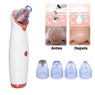 Removedor de cravos por dermo sucção, cravos, espinhas, mulher, beleza feminina, mulher, saúde e beleza, frete grátis, parcelamento em até 12x, estética, atitude feminina, attitude feminina.
