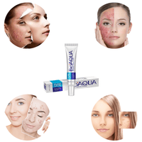 Creme Contra Acne, Controle de Oleosidade, Diminuição de Poros, Remoção de Cicatrizes de Acne, Cuidado com o Rosto Creme de Cuidado com o Rosto, para o tratamento de acne, cicatrizes. Attitude feminina, atitude feminina, toda mulher merece, beleza feminina, saúde da mulher